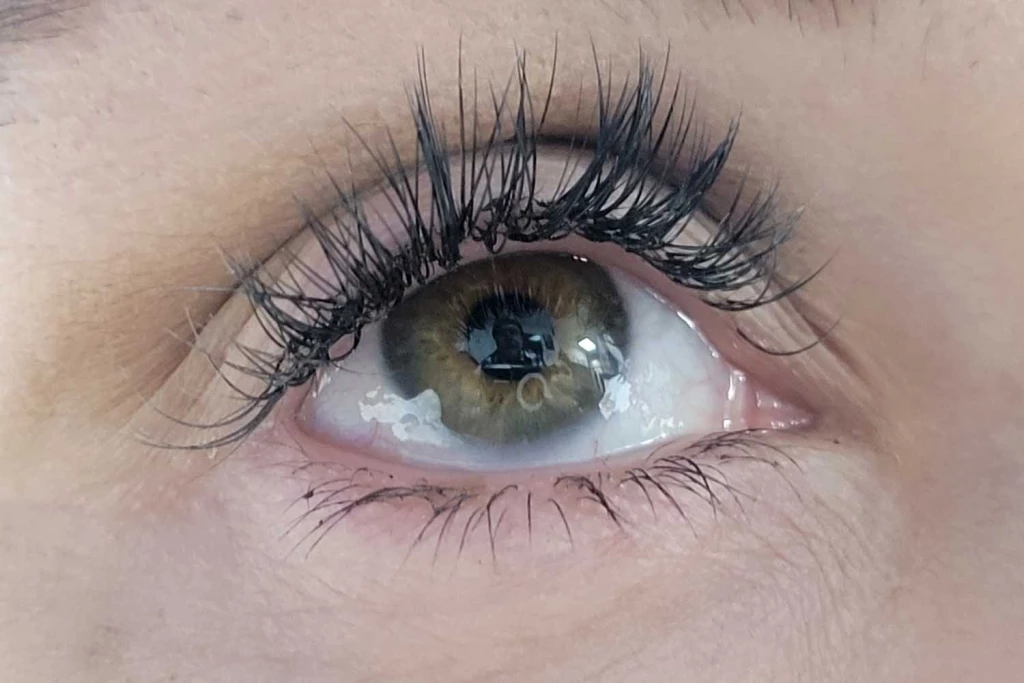 Prevengase de los ojos secos en este invierno