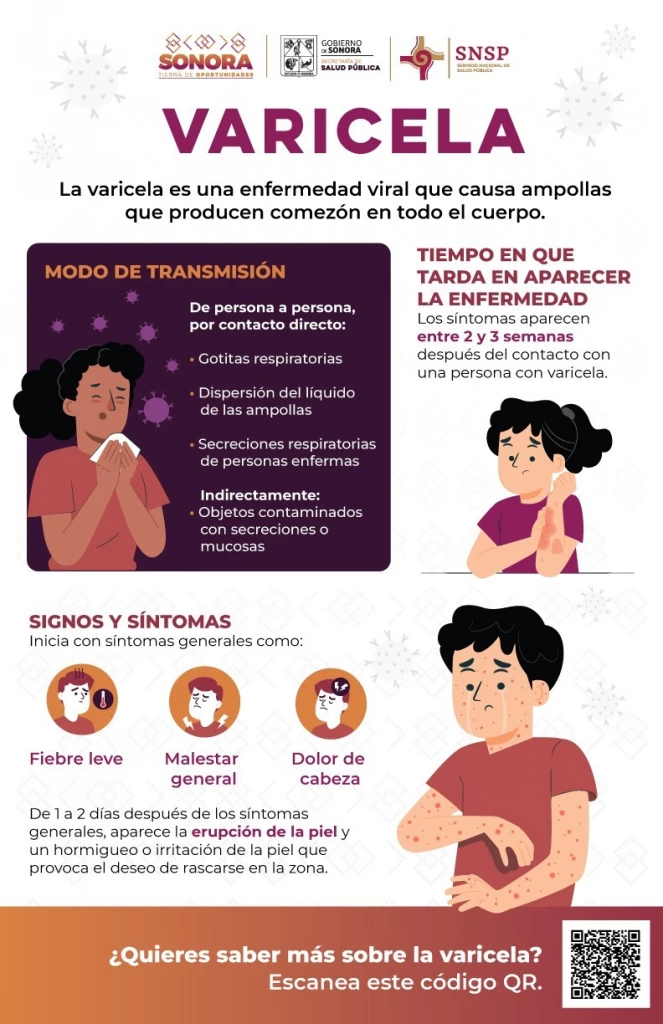 Salud Sonora refuerza medidas para prevenir la varicela