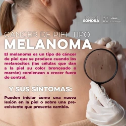 Atiende Gobierno de Sonora a 200 personas en primera jornada dermatológica