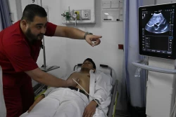 Inteligencia artificial usado en medicina
