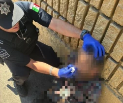 Policías salvan la vida de un hombre tras sobredosis en Nogales