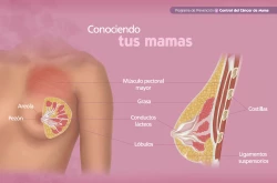 Más de 8 mil 400 mujeres murieron en el 2024 por  cáncer de mama